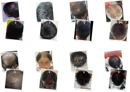 Before & After Results